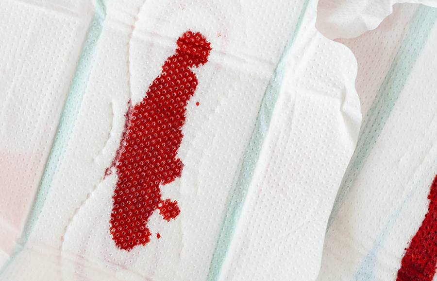 Are Big Blood Clots Normal During A Period? DAME